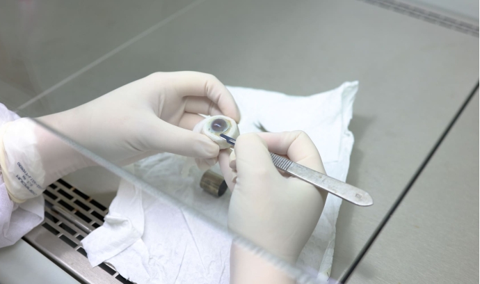 Banco de Olhos de Cascavel ultrapassa 7 mil doações em 20 anos e reforça a importância do gesto